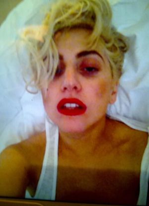Леди Гага выложила в twitter шокирующую фотографию